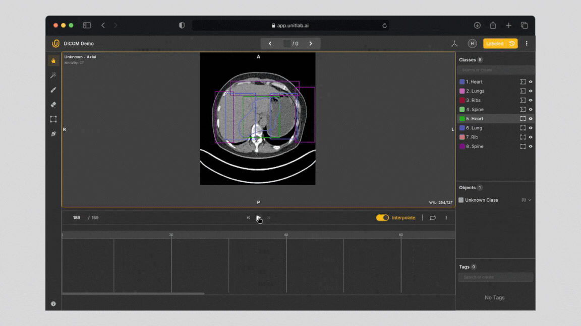 Interpolation Example with Heart and Lung Annotation