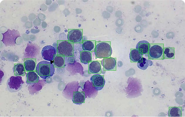 Cancer Screening with Computer Vision