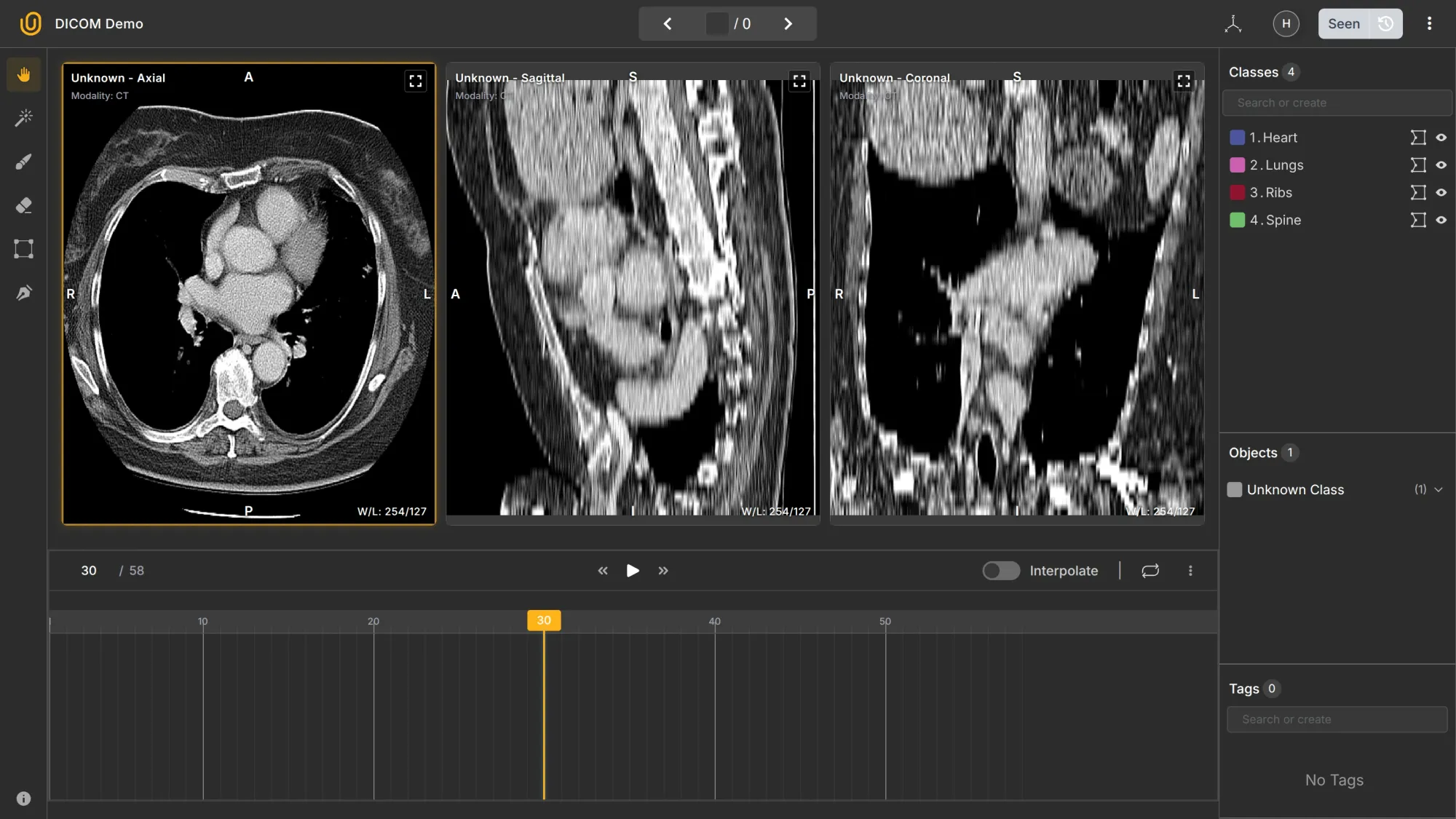 Medical Image Annotation Dashboard | Unitlab Annotate