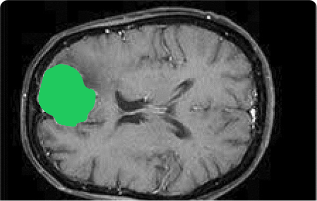 The Guide to Medical Image Annotation: Essentials, Techniques, Tools [2025]