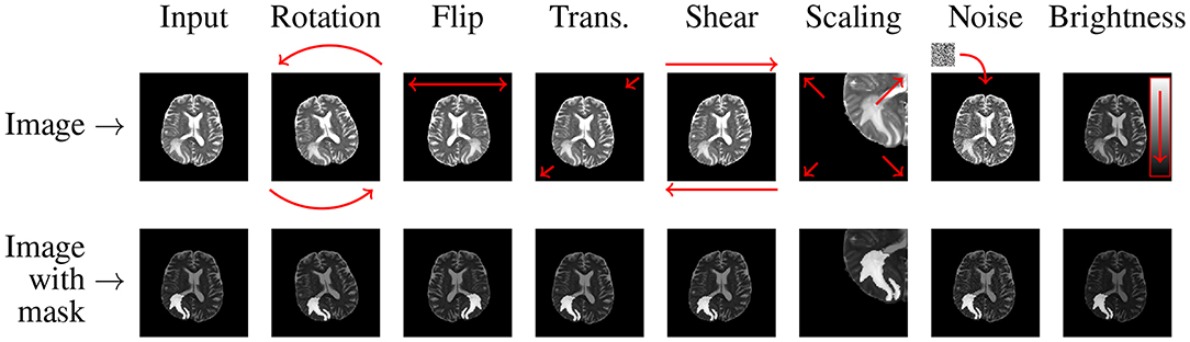 Figure 29: Medical image data augmentation.