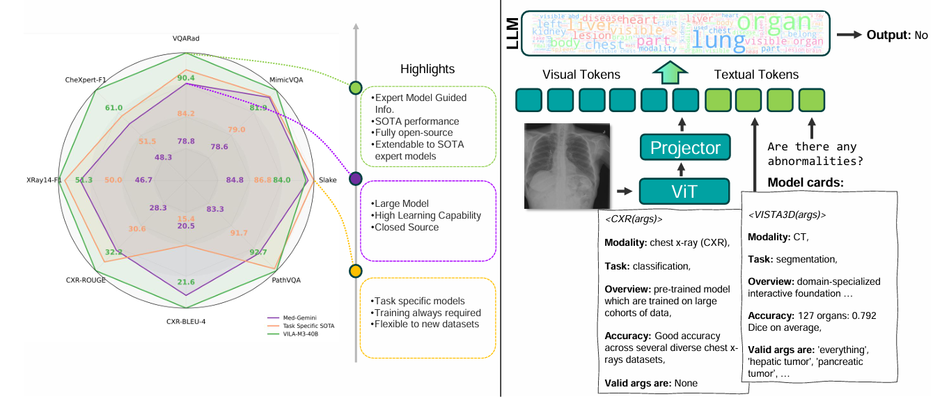Figure 4: VILA-M3 architecture overview.