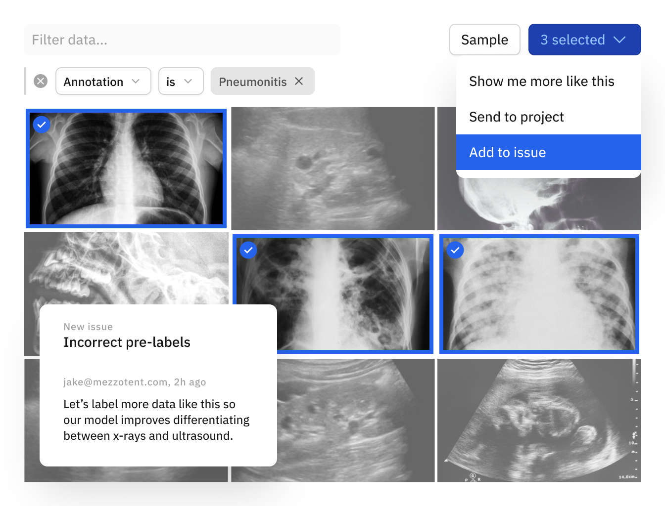 Labelbox Medical Image Annotation
