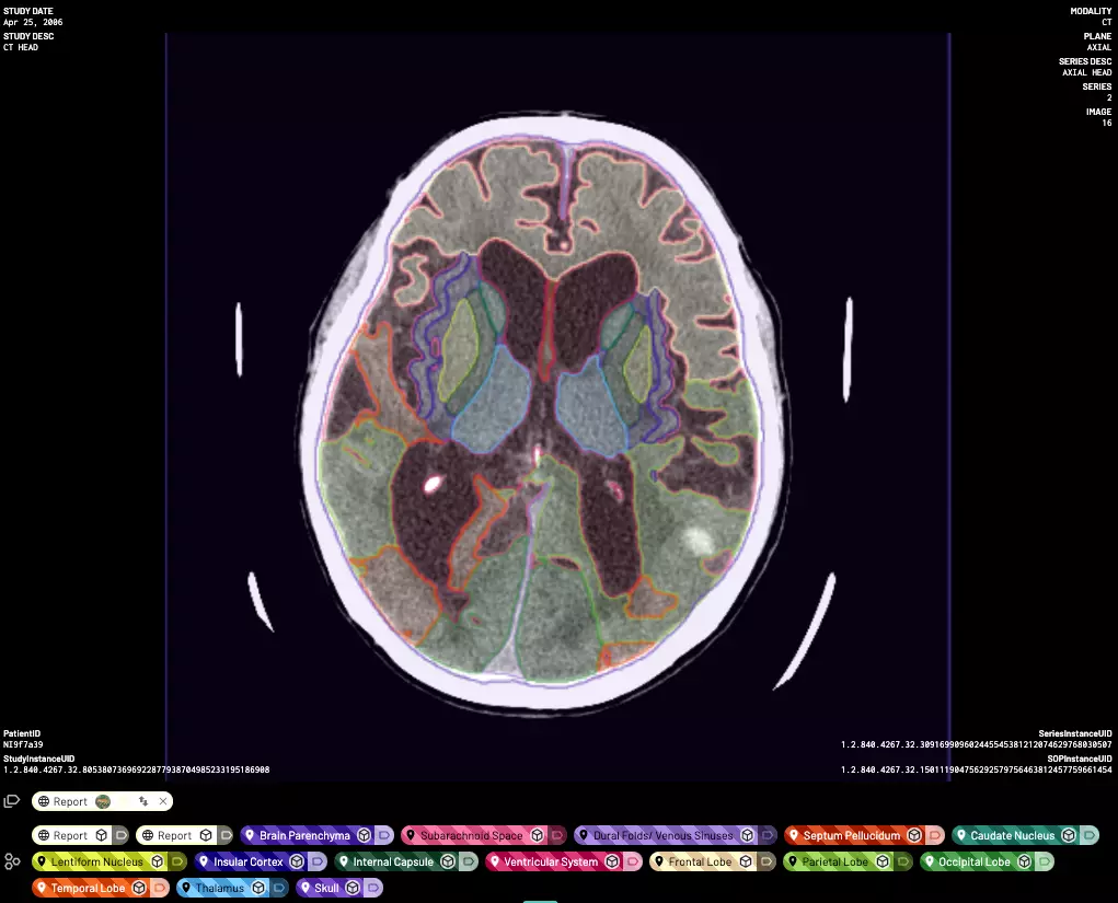 MD.AI Medical Labeling