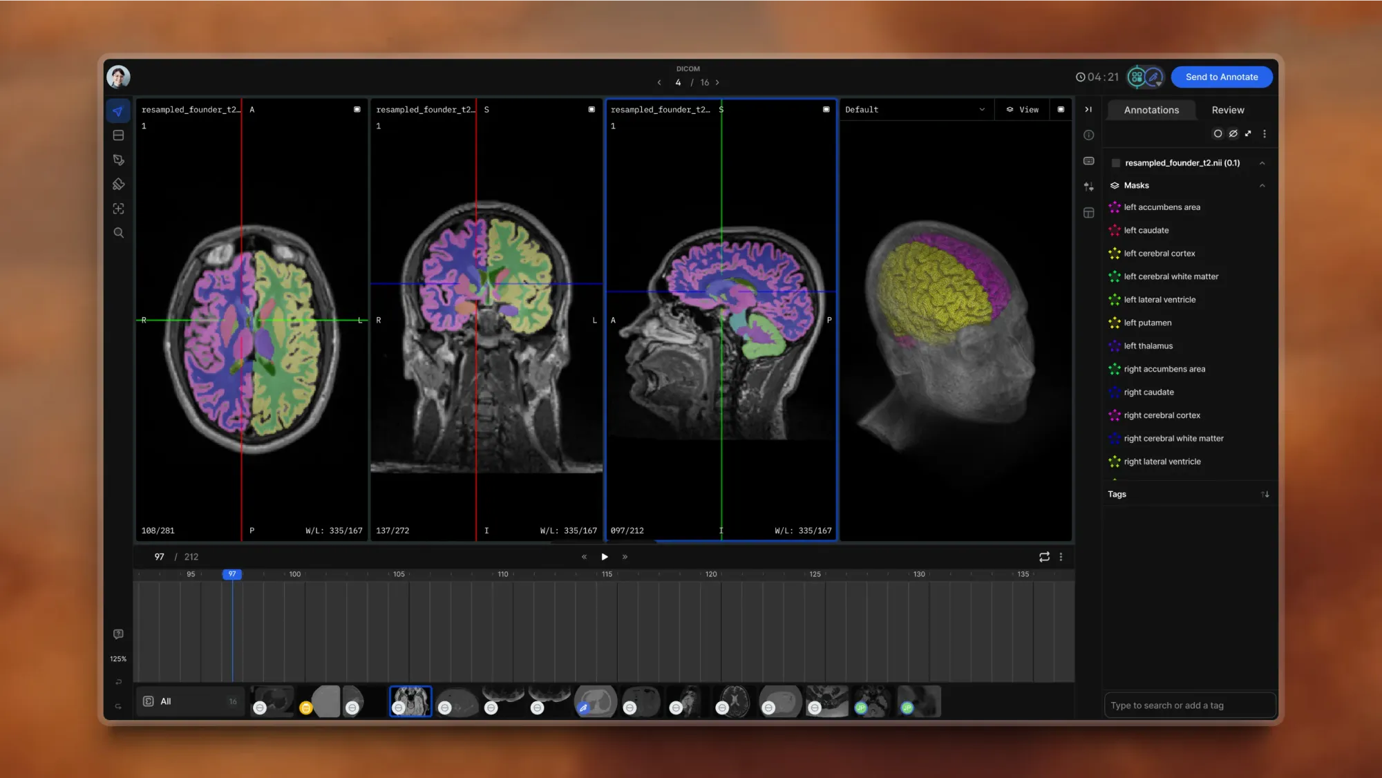 V7 Darwin DICOM Viewer