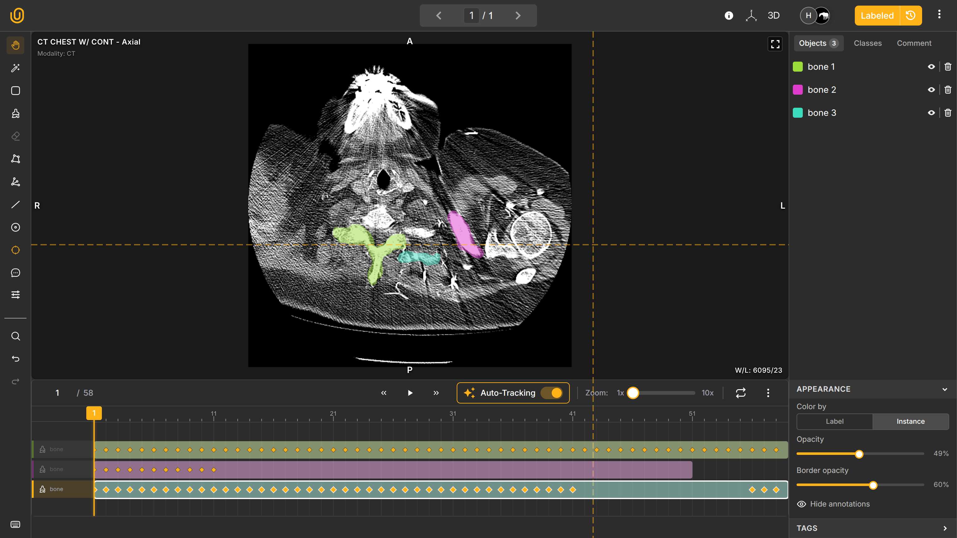Default Medical Annotation Dashboard | Unitlab AI