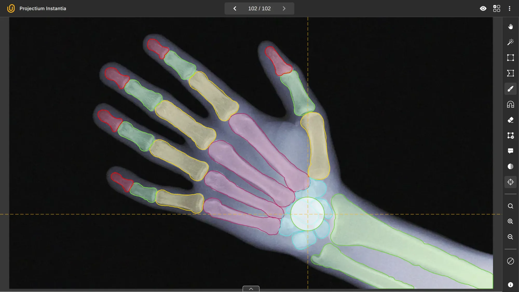 Why Outsource Medical Data Labeling?