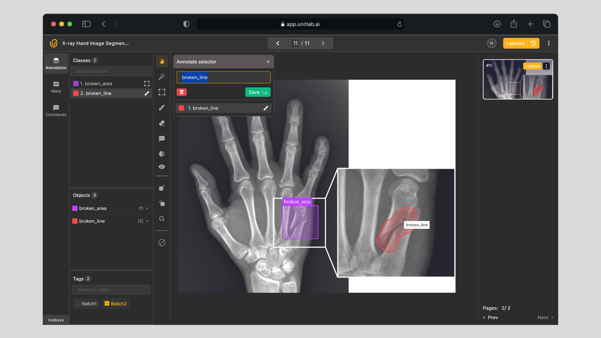 The Guide to Medical Image Annotation: Essentials, Techniques, Tools [2025]