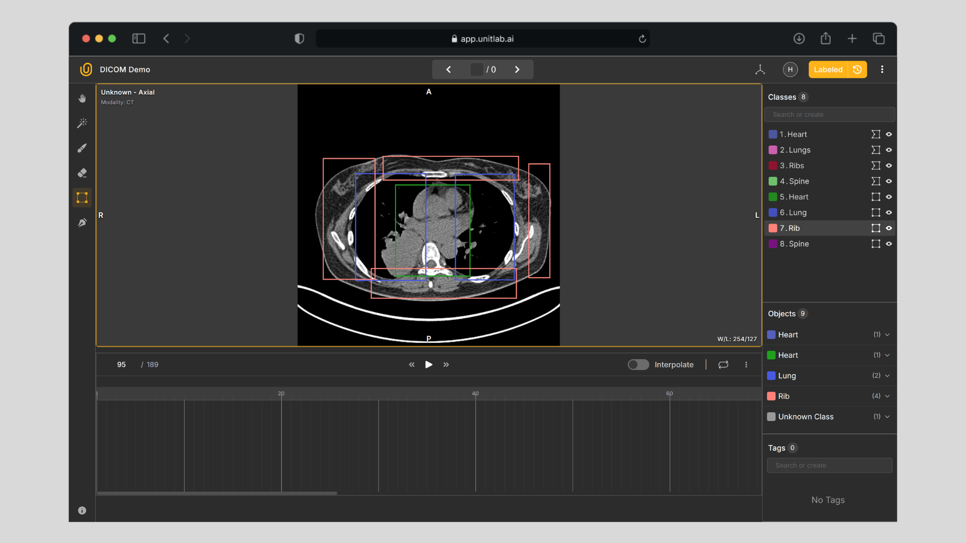 The Guide to Medical Image Annotation: Essentials, Techniques, Tools [2025]