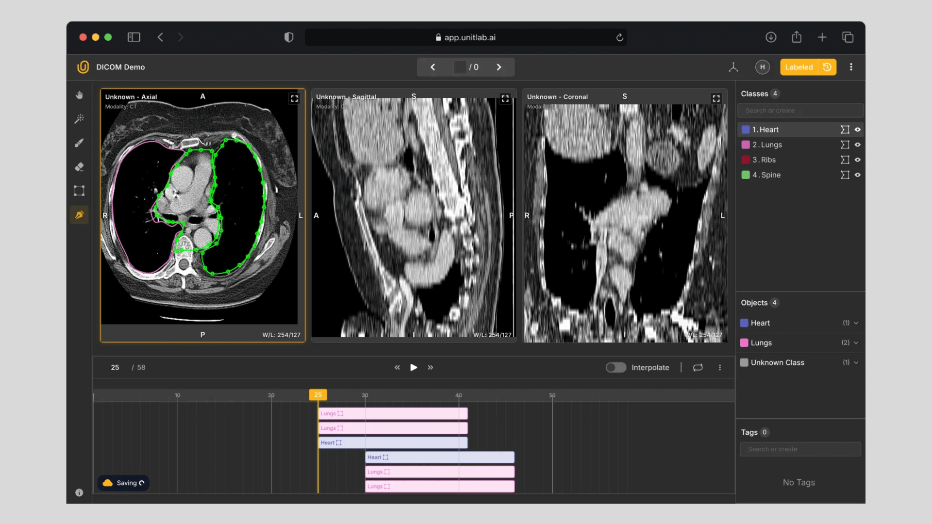 The Guide to Medical Image Annotation: Essentials, Techniques, Tools [2025]