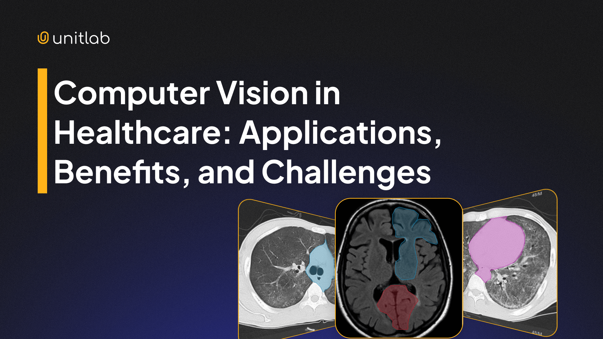 Computer Vision in Healthcare: Applications, Benefits, and Challenges