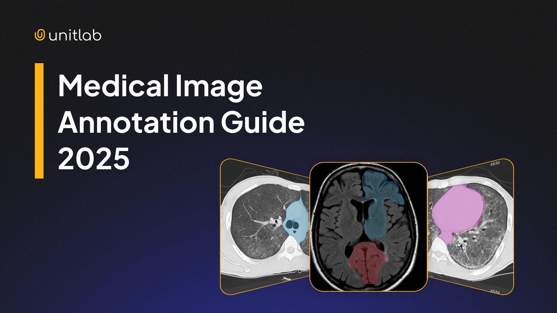 The Guide to Medical Image Annotation: Essentials, Techniques, Tools [2025]