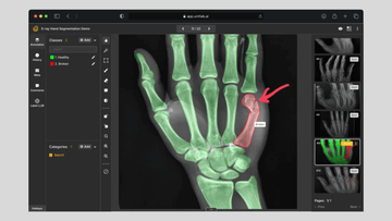Computer Vision in Healthcare: Applications, Benefits, and Challenges