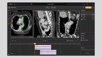 The Guide to Medical Image Annotation: Essentials, Techniques, Tools [2025]